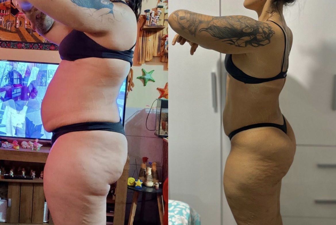 Antes e Depois 1