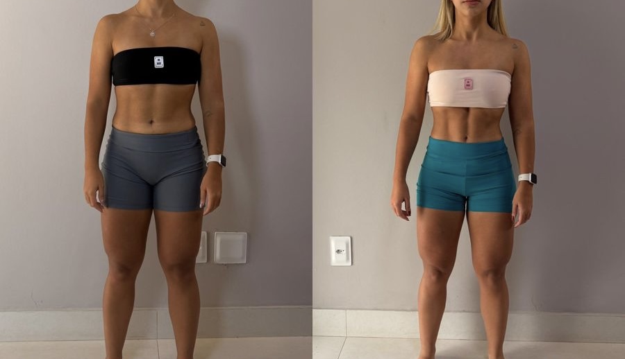 Antes e Depois 2