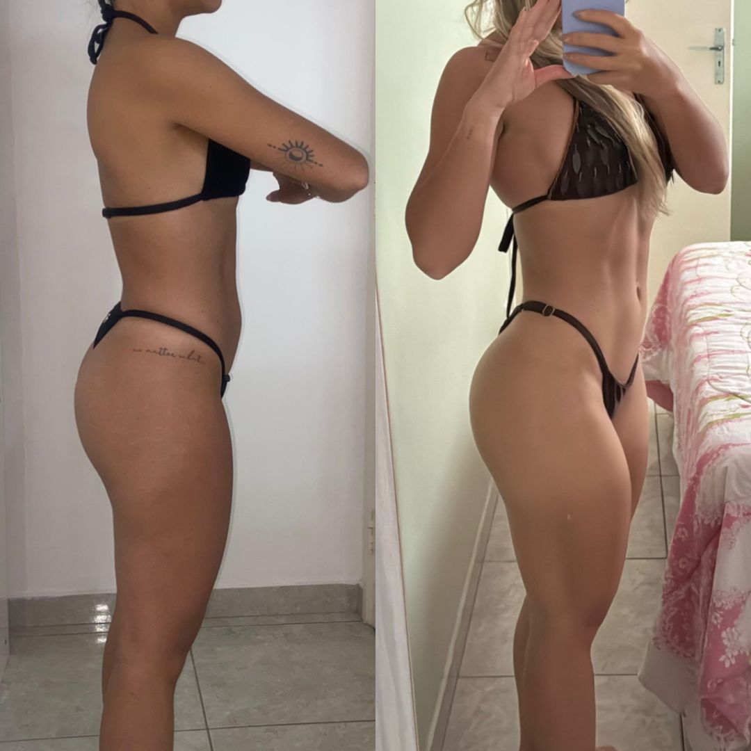 Antes e Depois 7