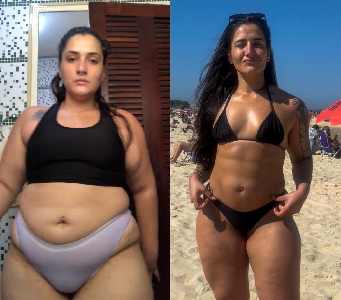 Antes e Depois 10