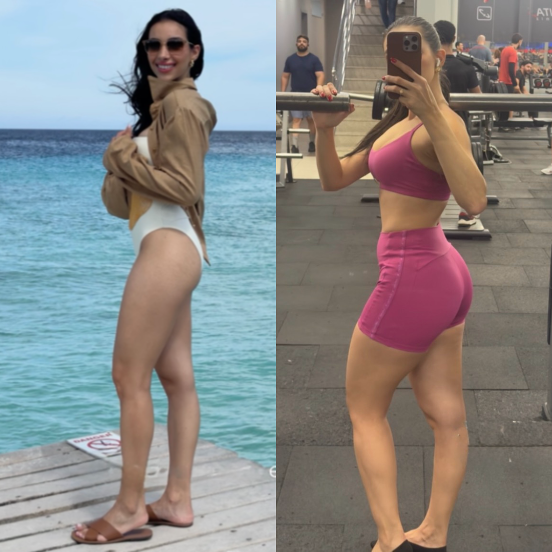 Antes e Depois 3